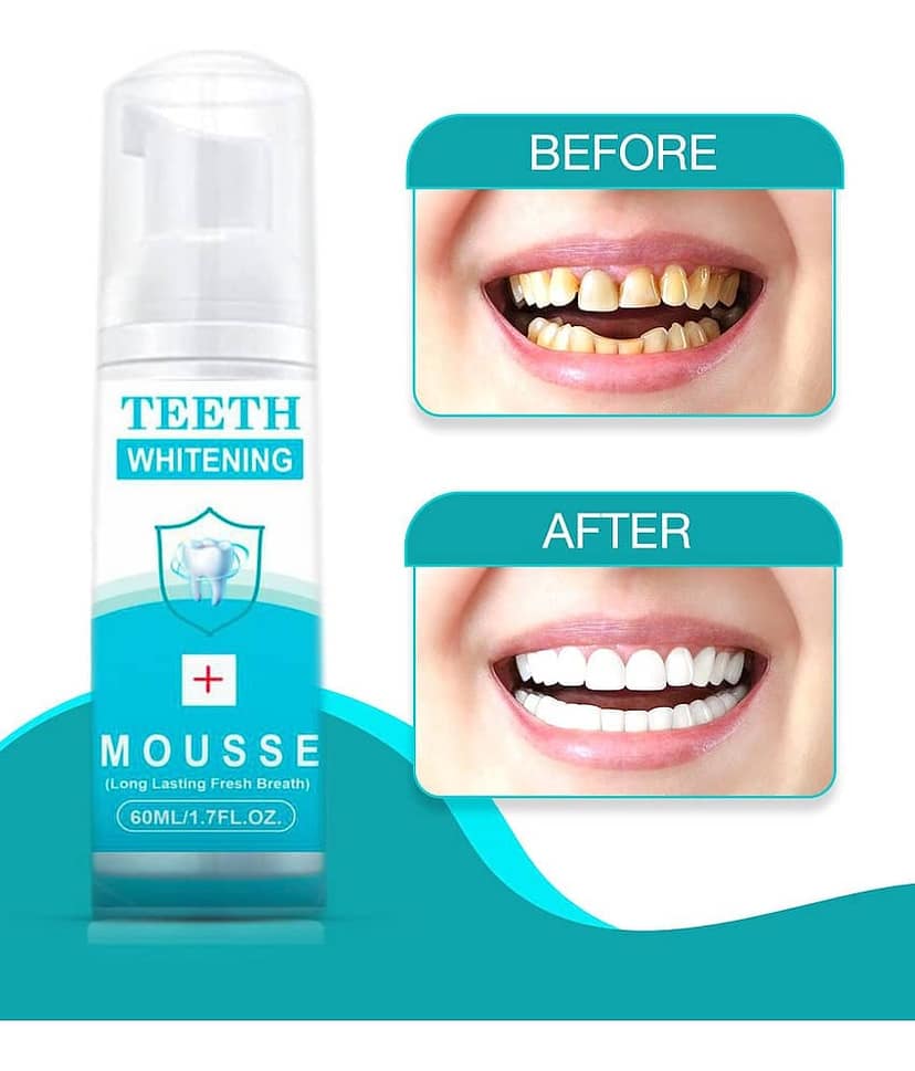 Gantavya Advance Teeth Whitening, Deep Cleanser Denture Oral Kit