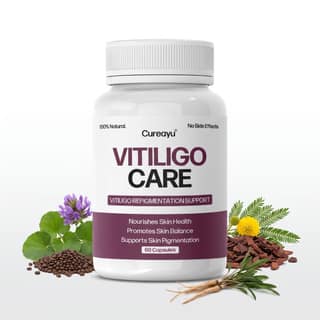 Cureayu Vitiligo Care | Ayurvedic Capsules for Skin Health & Pigmentation Support
