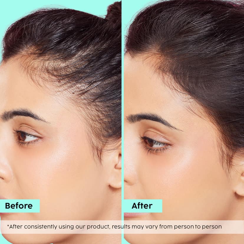 Rosemary Hair Growth Advanced Hair Oil __Starter Pack__ view 2