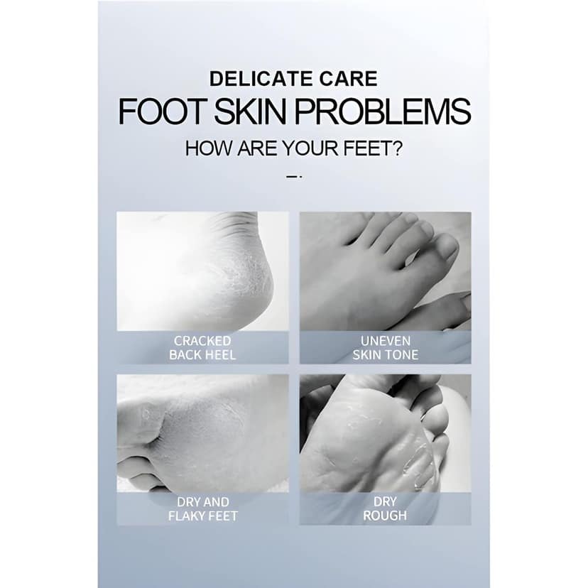 Deep Moisturizing Foot Hydration Socks with Lavender | Exfoliating Foot Peel Mask for Cracked Heels & Dead Skin Removal | At-Home Pedicure Socks for Soft & Smooth Baby Feet (Original) view 4