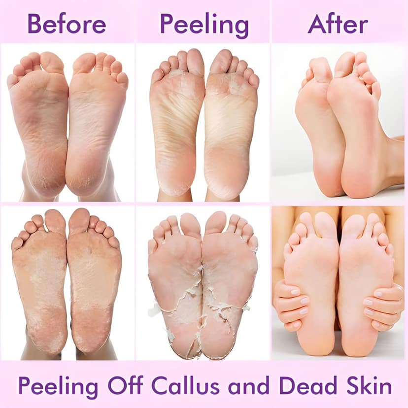 Deep Moisturizing Foot Hydration Socks with Lavender | Exfoliating Foot Peel Mask for Cracked Heels & Dead Skin Removal | At-Home Pedicure Socks for Soft & Smooth Baby Feet (Original) view 5