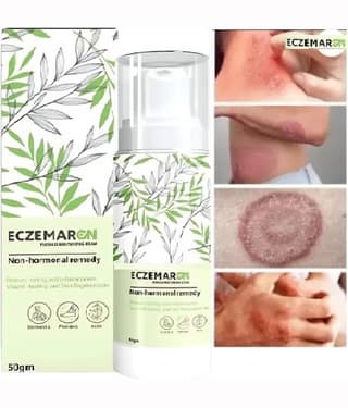 Treszo Moisturizer All Skin Type Vitamin C ( 50 gm )