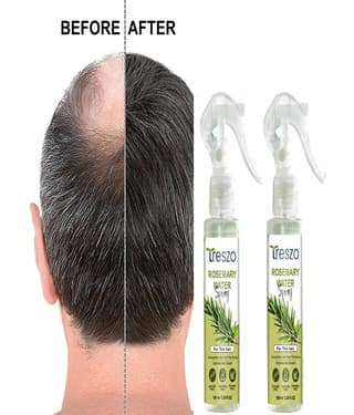 Treszo Rosemary Hair Growth Hair Serum 100 mL Pack of 2