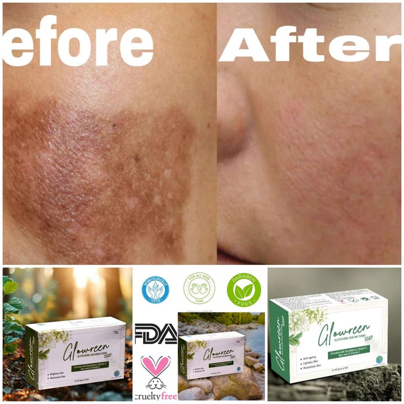 Glowreen Glutathione Skin Whitening, Brightening, Vitamin C, Aloe Vera Soap view 5
