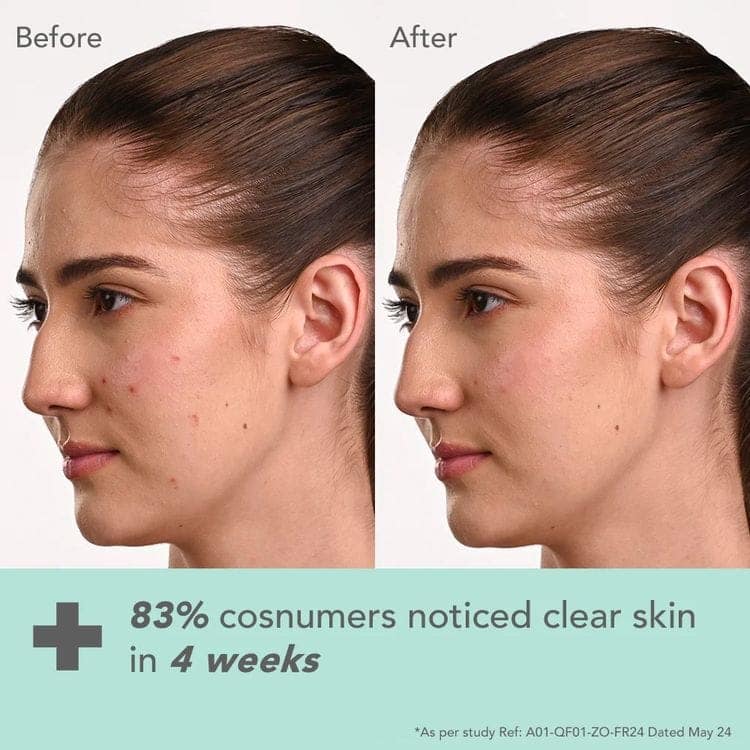 Lotus Herbals Lotus Dermabotanics Kojic Acid + Multi Berry Ampoule Face Cream pH5.5 Suitable For Sensitive Skin (50g) view 4