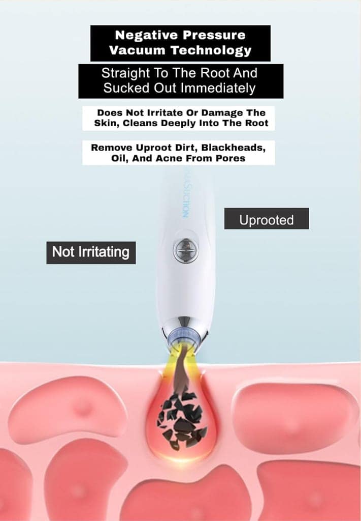 4 in 1 Multi-Function Blackhead Whitehead Extractor Remover Device, Skin Cleaner, Pimple Removal Tool, Acne Pimple Pore Cleaner Vacuum Suction Tool for Men and Women (white) view 4
