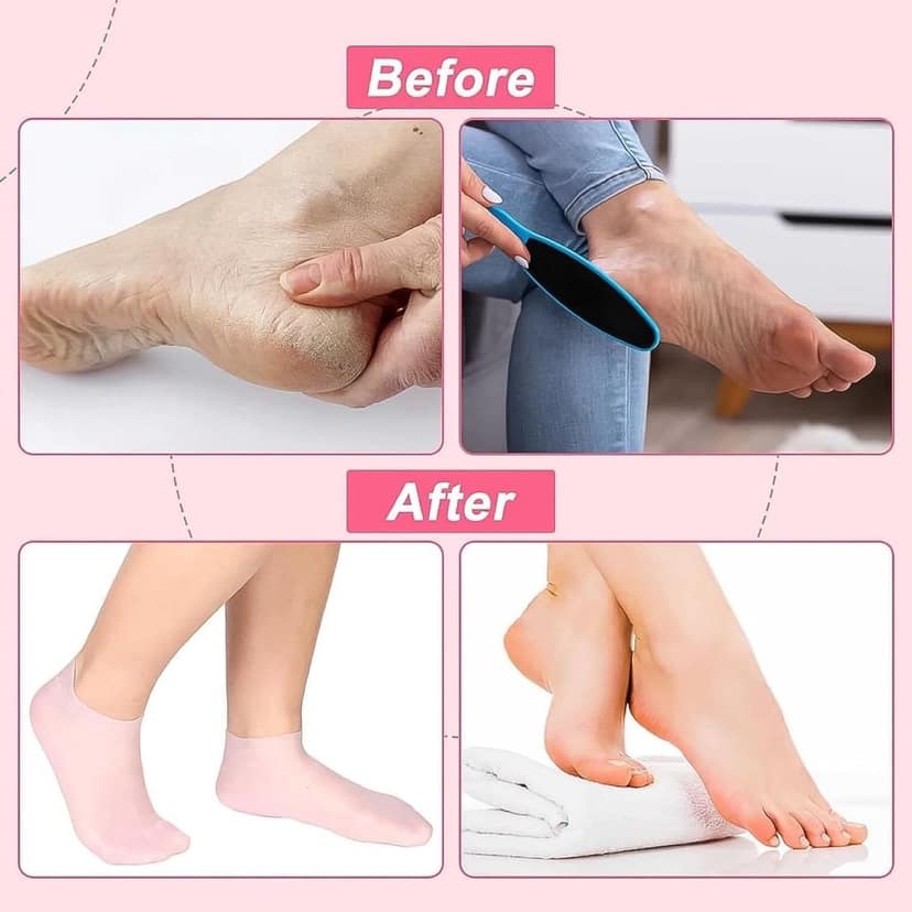 Silicone Moisturizing Socks (1 Pair) view 5