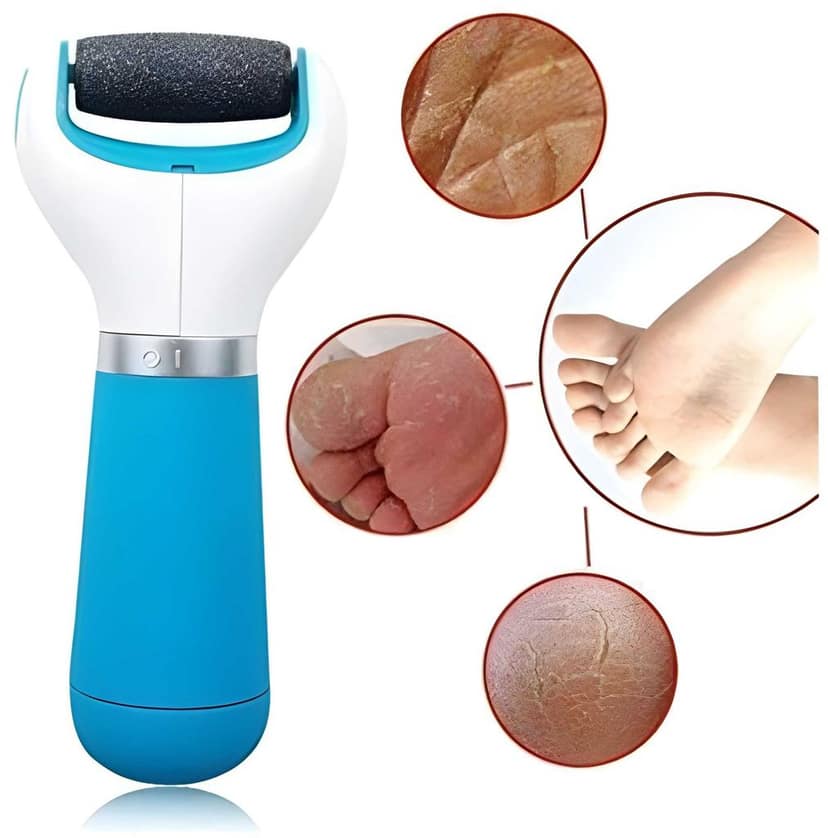 Foot Roller Callus Remover | Hard & Dead Skin Remover | Pedicure Tool for Cracked Feet | Foot Scrubber Roller (Original Quality) view 2
