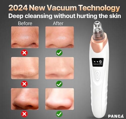 PANCA 5-in-1 Blackhead Remover Machine | Electric Pore Cleaner & Whitehead Removal Tool | USB Rechargeable Skin Care Device for Face Cleansing & Exfoliation (Black) view 3