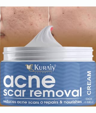 KURAIY Acne Face Cream Herbal Pimple Scar Removal Shrink Pore Oil Control Moisturizing Cream