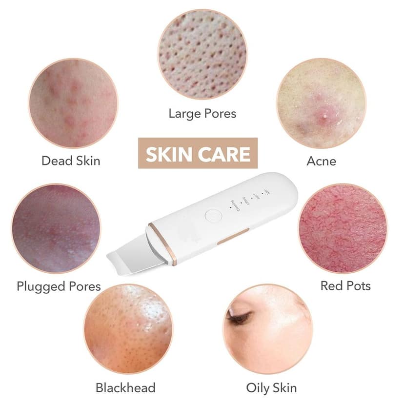 AUSHA 4-in-1 Ultrasonic Skin Scrubber | Deep Cleansing, Blackhead Removal & Facial Massage view 5
