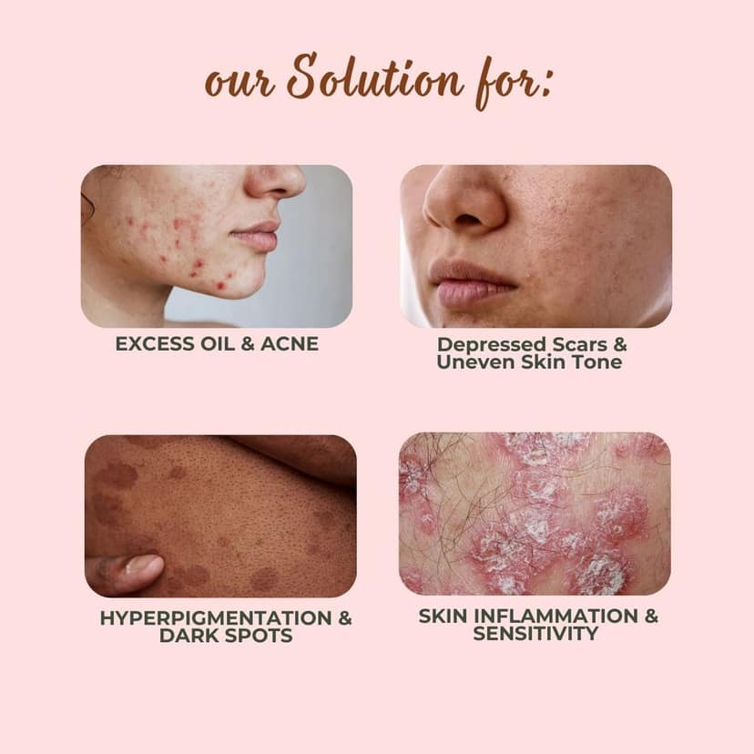 MrilQ Dusk Face Wash Plus | Scars, Marks & Pigmentation | Severe Acne | Oily, Sensitive, Combination Skin view 6