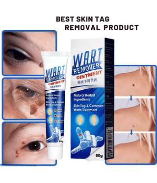 Massa Cream for Remove Warts Blackhead Remover