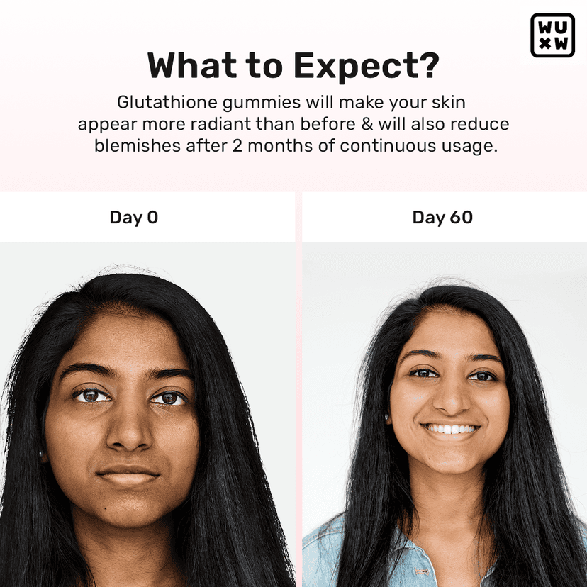 What's Up Gluta-Glow Gummies version 2 What's Up Gluta-Glow Gummies version 2 - 30 Days Pack view 2