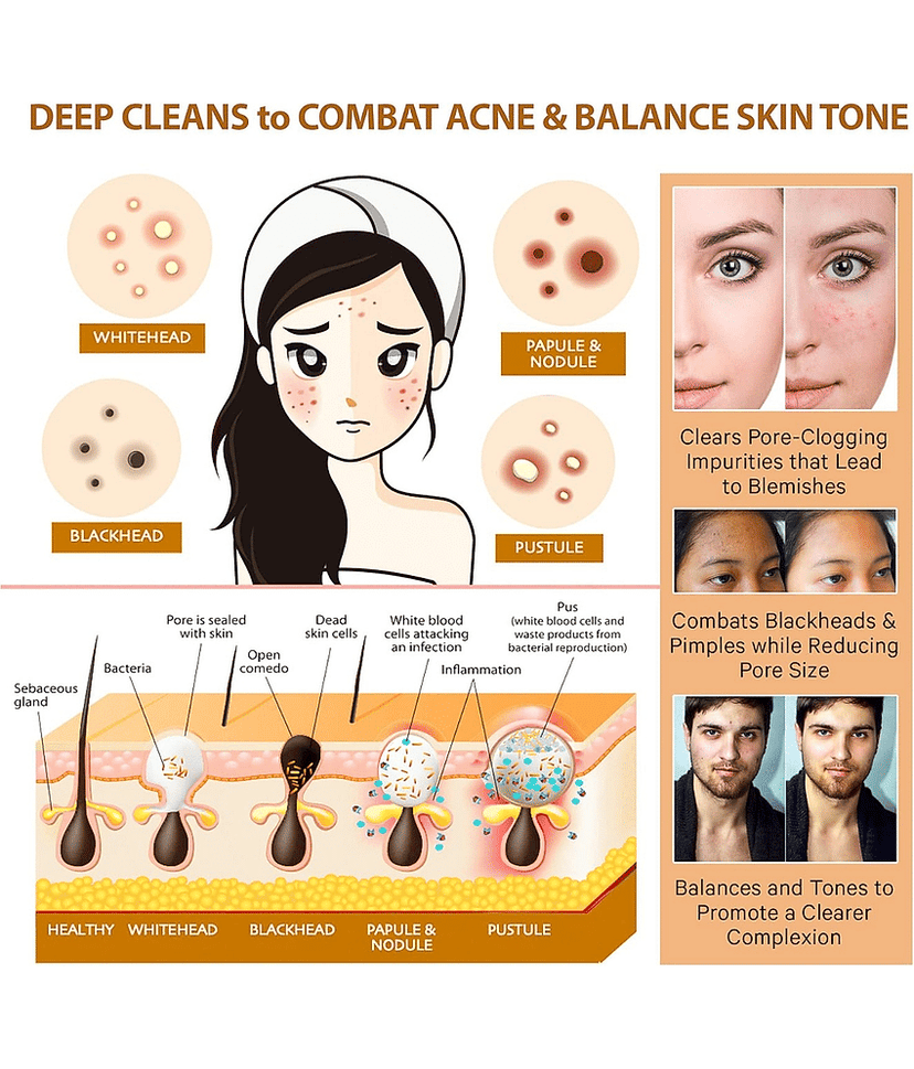 Phillauri Anti-acne & Pimples Facial Scrub For Men & Women ( Pack of 2 ) view 2