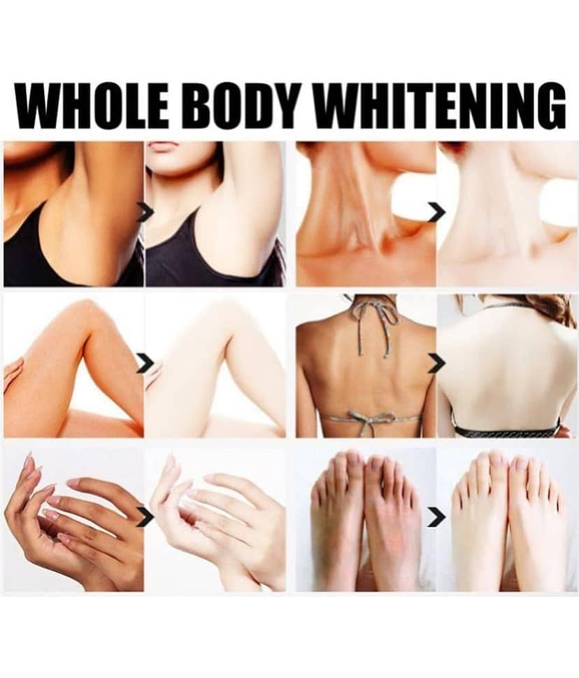 KURAIY Whitening Cream To Remove Melanin For Men & Women (50gm) Pack of 1 view 2