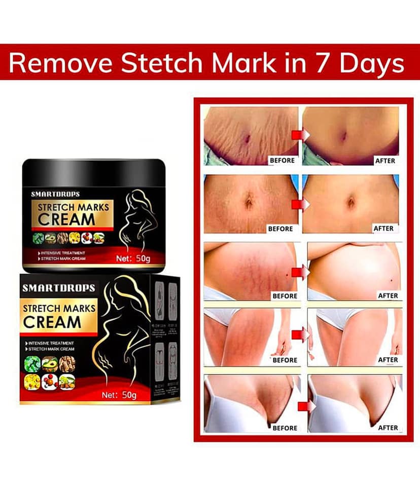 Smartdrops Pragnancy Stretch Mark Remove Cream Shaping & Firming Cream 50 g - Pack of 1 view 2