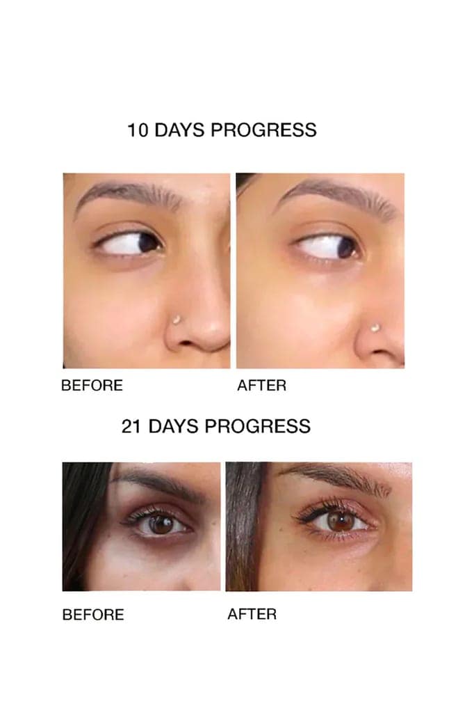 UNDER EYE REPAIR OIL (10ml) view 2