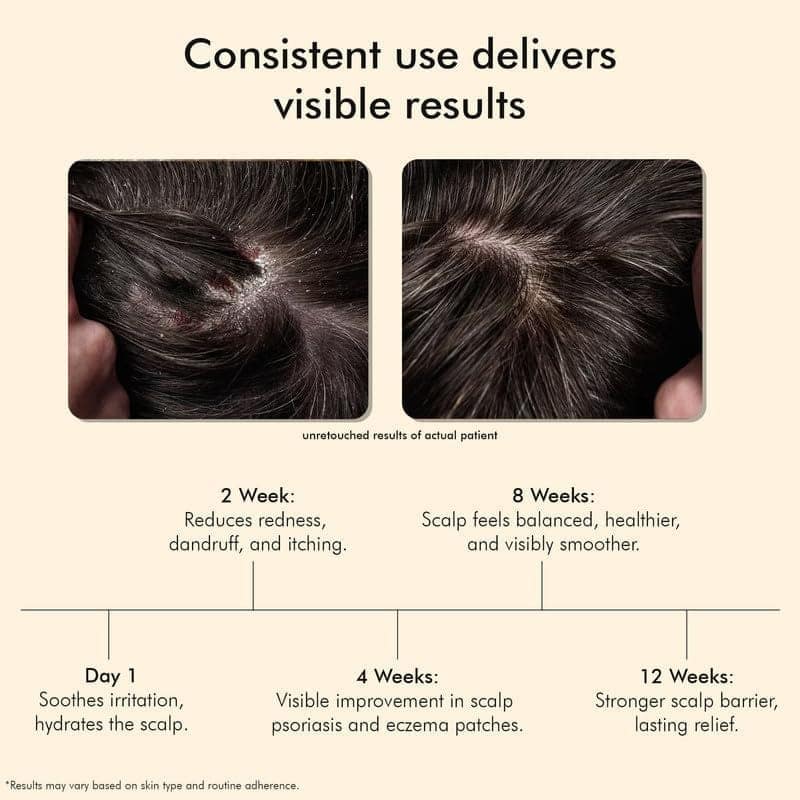 VEDICDERM 24Kt Nano Gold Hair Serum 100ml | Soothing Scalp Care For Psoriatic, Sensitive Scalp | Reduces Itching, Flaking & Redness | Strengthens Hair & Hydrates Scalp | Paraban & Sulfate Free Formula view 2