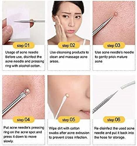 Elecsera Blackhead Comedone Acne Blemish Remover Stainless Needles Remove Tool Kit (Silver) - (Pack of 4) view 2