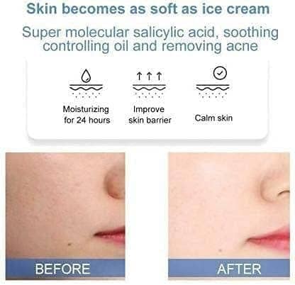 Elecsera Natural Ice Cream Mask Tube Ultra Cleansing Ice Cream Mask ice cream Acne Fades Moisturizing Smear Mask Blackheads Remover & Shrinking Pores view 2